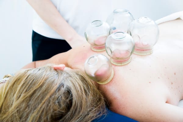 Velkommen til cupping – en ældgammel behandling med moderne effekt